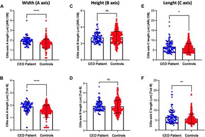 Ciliary phenotyping in renal epithelial cells in a cranioectodermal dysplasia patient with WDR35 variants